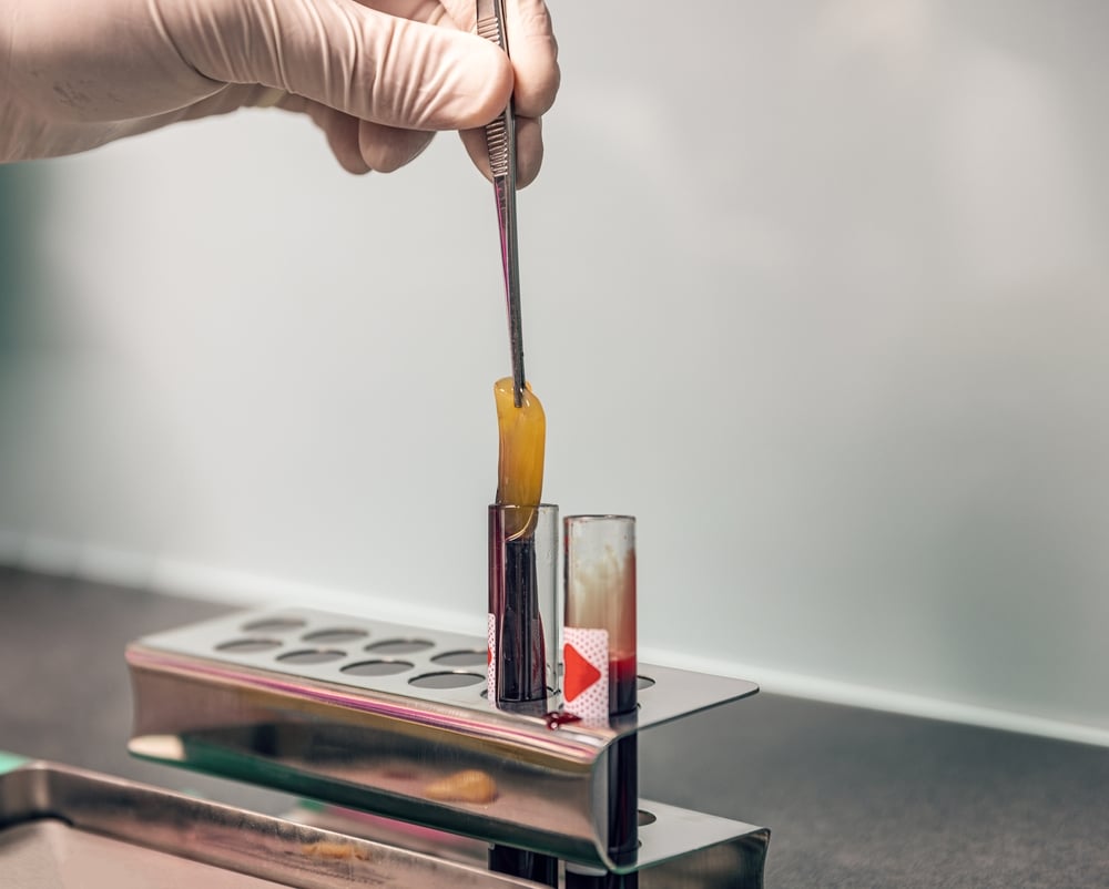 PRF vs. Other Skin Treatments: What Makes PRF Unique? | AMG Aesthetics