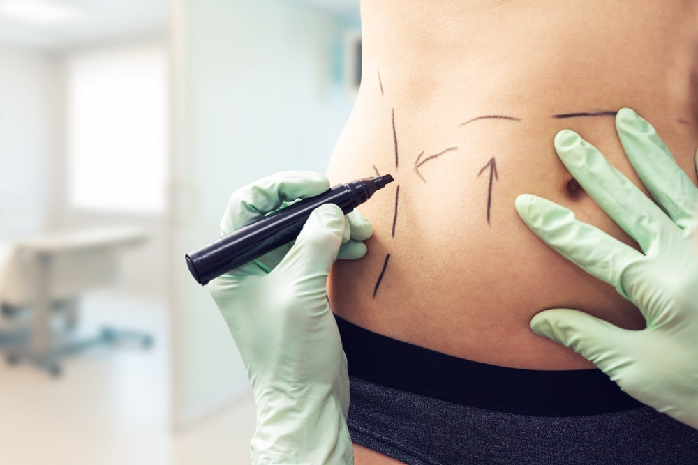 Body Contouring | AMG Aesthetics